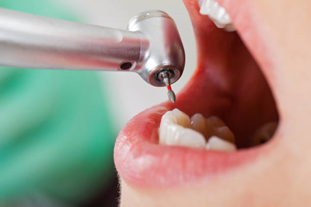 Best Walk-In Emergency Dentist in Los Osos, CA